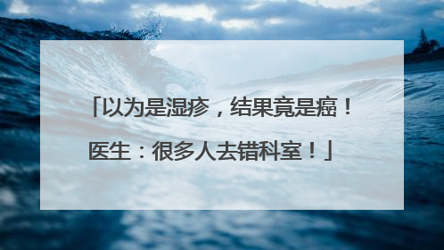以为是湿疹，结果竟是癌！医生：很多人去错科室！